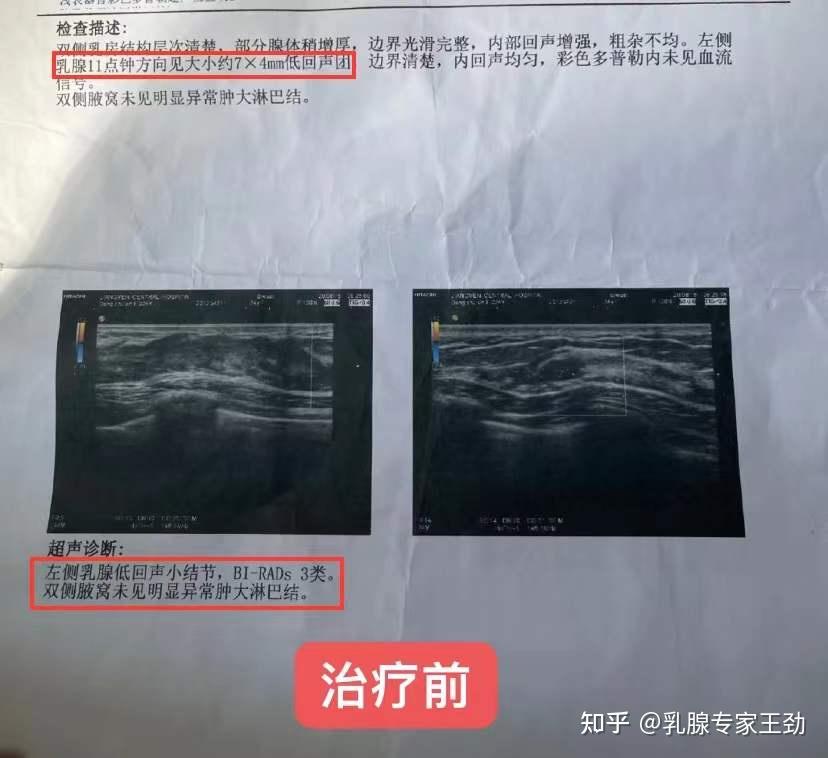 多囊卵巢优生代怀婴儿需要多少钱,附近几年试管助孕价格表