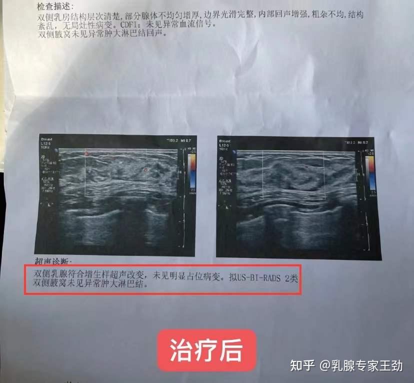 停经女性,还能通过捐卵助孕生孩子吗